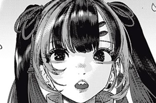 第４７話 Common bile duct stone：総胆管結石① 표지