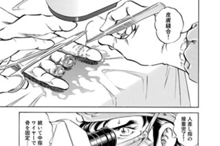 第１８７話 岐路（その１） 표지