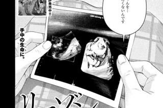 ＃１３９ 出生前診断① 표지