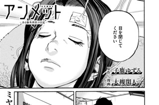 第４７話 側頭葉てんかん① 표지