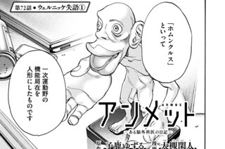 第７２話 ウェルニッケ失語① 표지