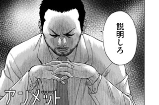 第２話 脳内血腫② 표지